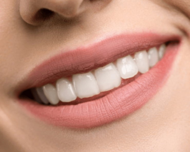 biele zuby úsmev