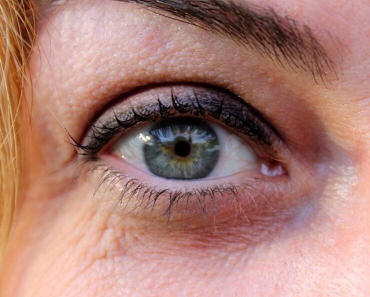 pokožka okolo očí